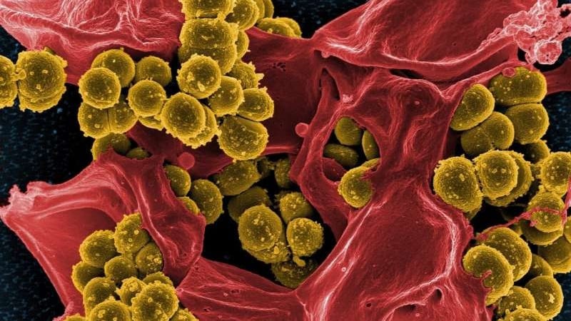 Antibiyotiklere dirençli bakteri türü |