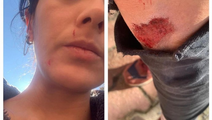 “Hakan Tosun’a yapıldığı gibi” |