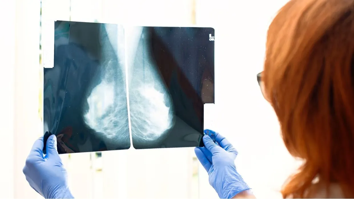 Meme kanserinde yeni kan testi |