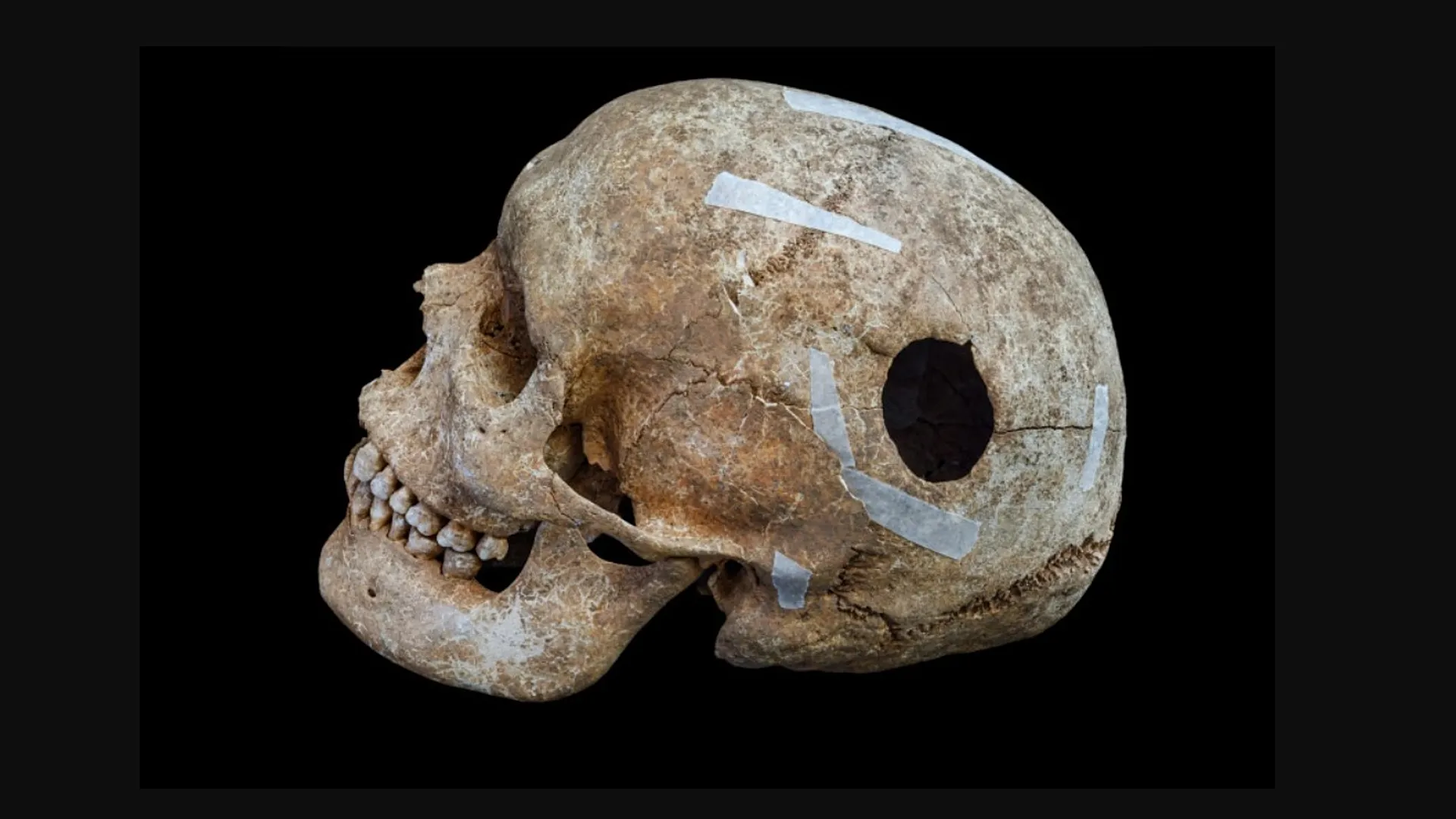 1,95 metrelik iskelet de var |