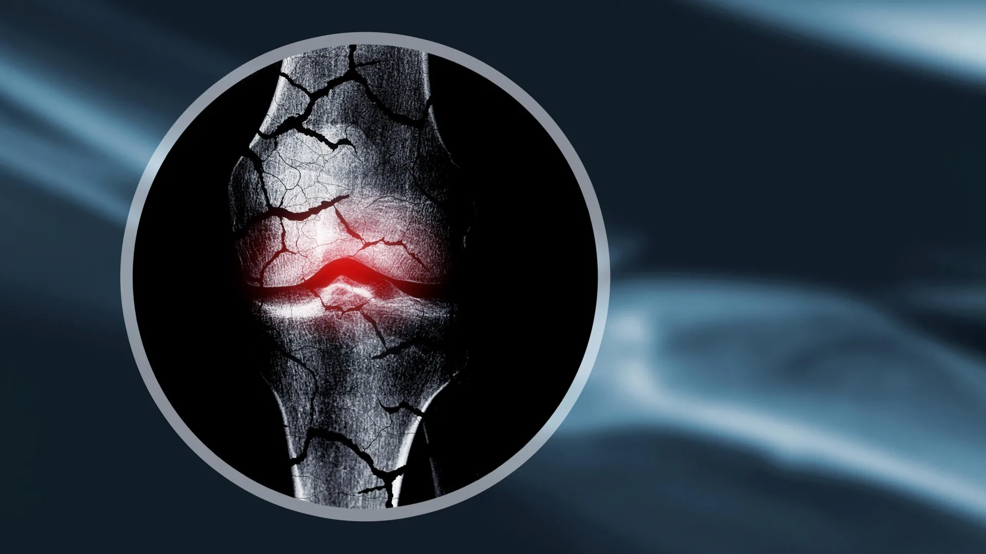 Kemik onarımında yeni yöntem |